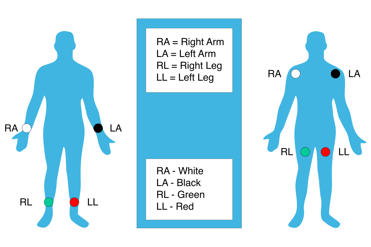 Applying EKG leads requires strict adherence to spatial transition terms to ensure correct anatomical placement.