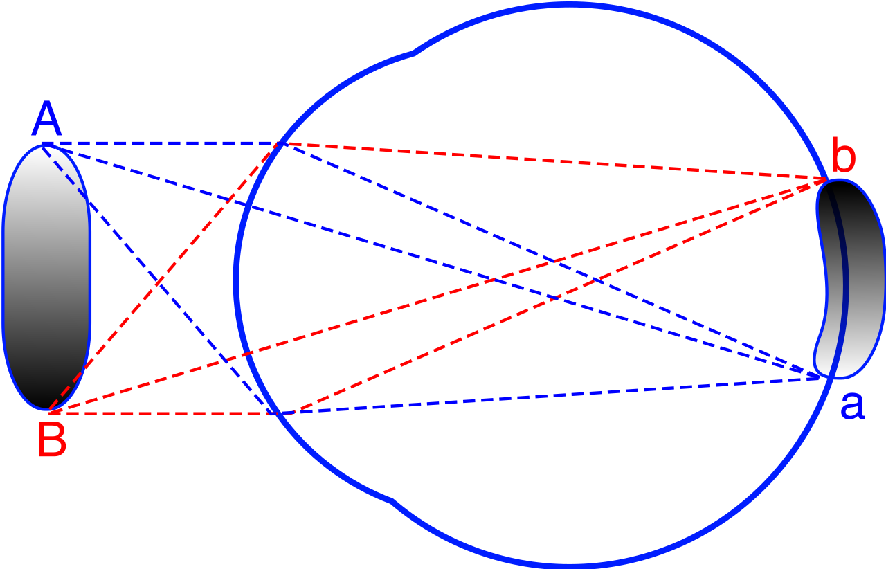 The human eye acts as a natural convex lens. Its shape forces incoming parallel light rays to converge to a single focal point directly on the retina, ensuring clear vision.