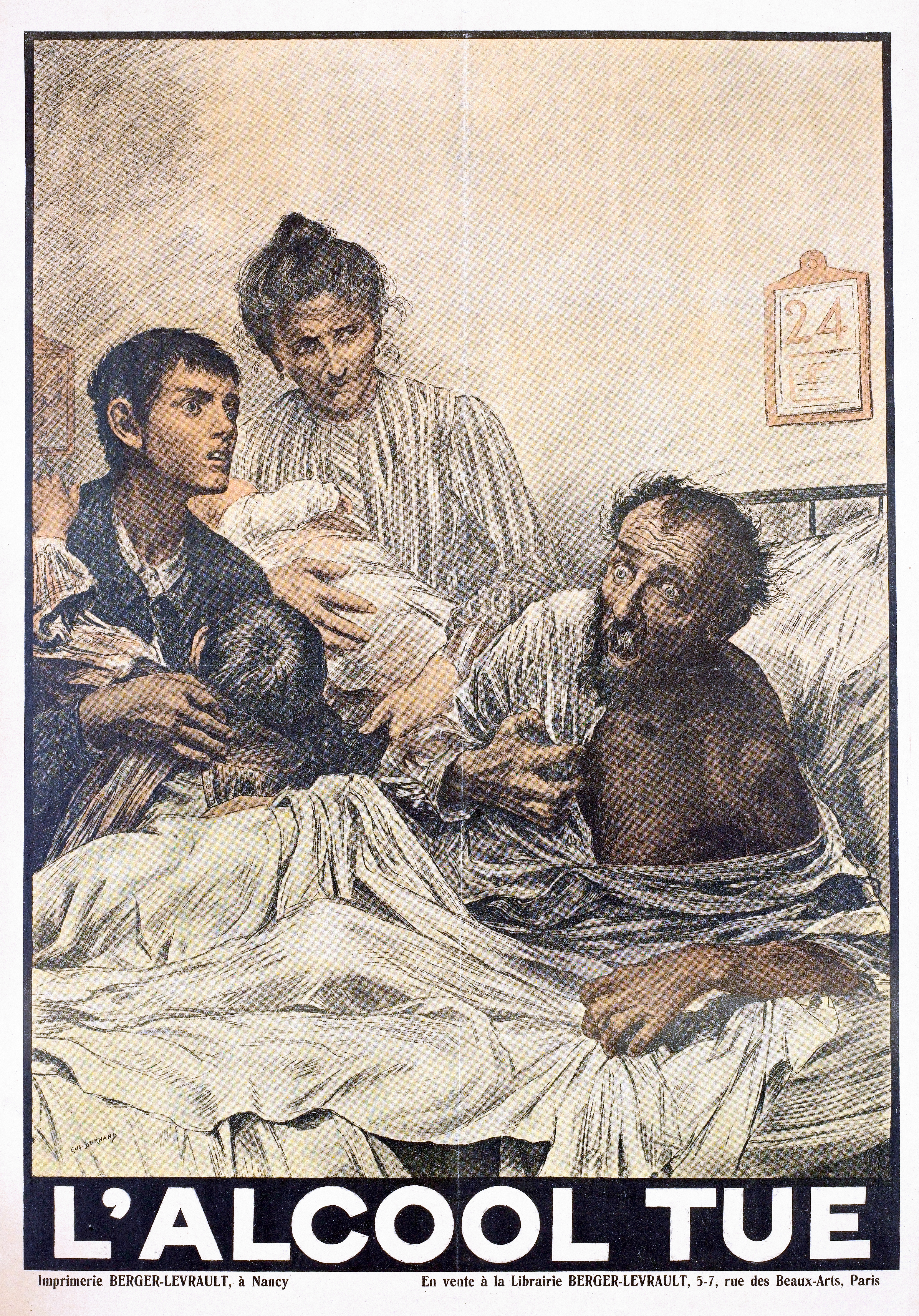 An acute confusional state during severe alcohol withdrawal, known as delirium tremens, which is characterized by hallucinations and profound autonomic instability.