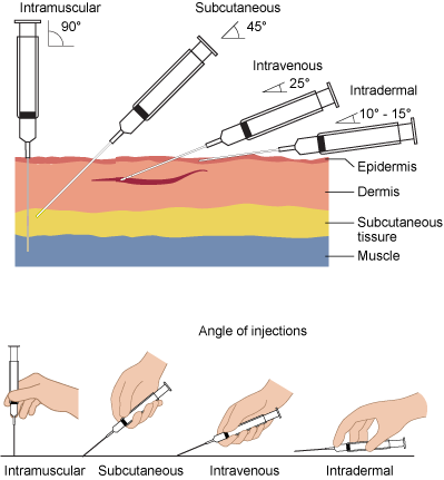 Standard needle insertion angles for parenteral medication administration. Intramuscular injections are delivered perpendicular to the skin at a 90-degree angle.