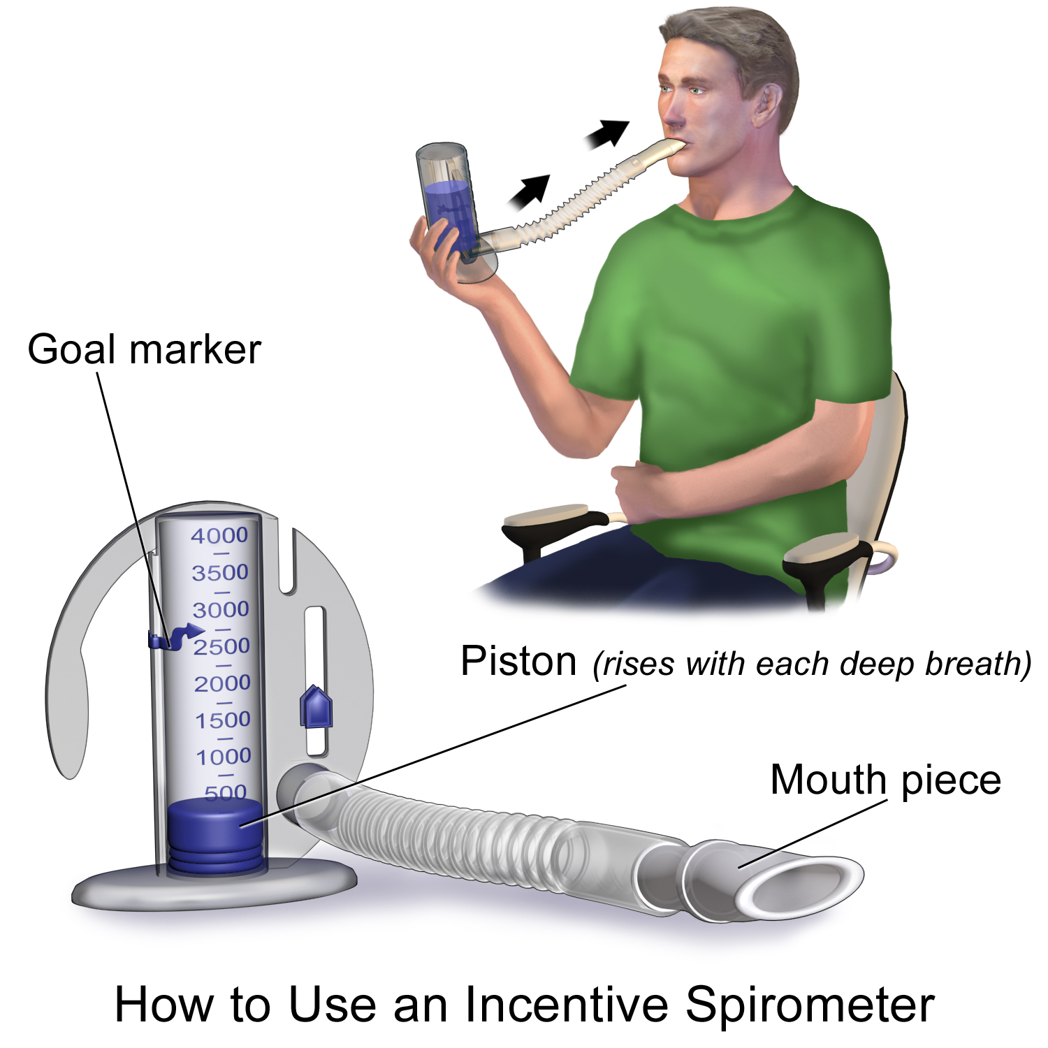 An incentive spirometer encourages deep, sustained mechanical expansion of the lungs to reverse atelectasis and prevent postoperative pulmonary complications like pneumonia.