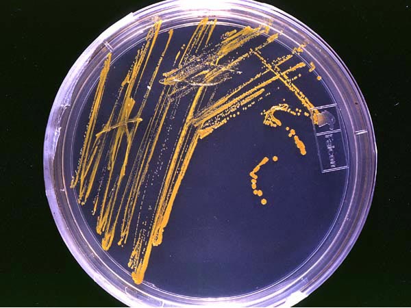 Prepared agar plates are stored upside down after the gel solidifies to ensure that condensation does not drip down and disrupt forming bacterial colonies.