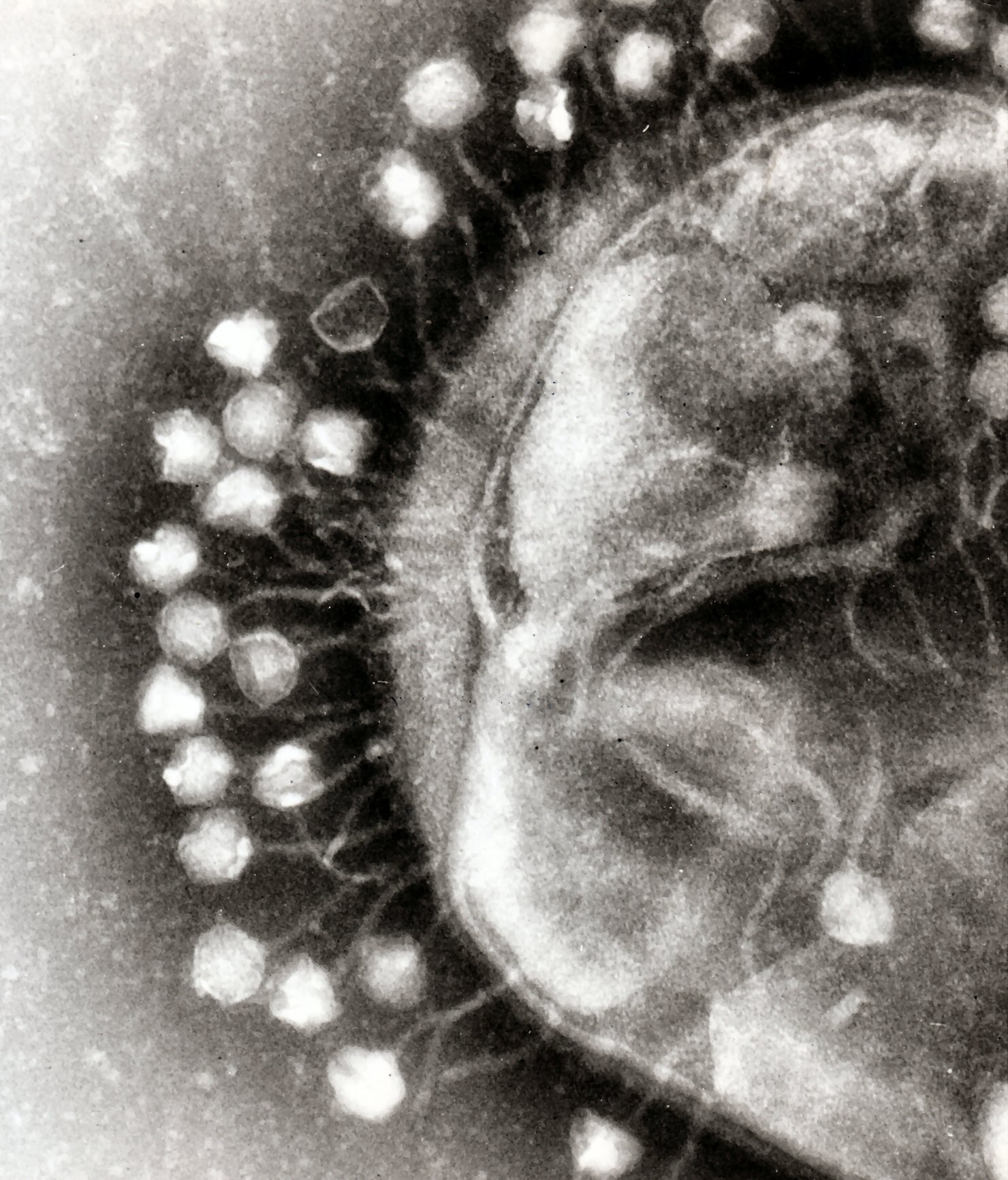 Transmission electron micrograph of multiple bacteriophages attached to a bacterial cell wall. Because they lack their own cellular machinery and cannot metabolize or reproduce independently, viruses are not classified as living organisms.