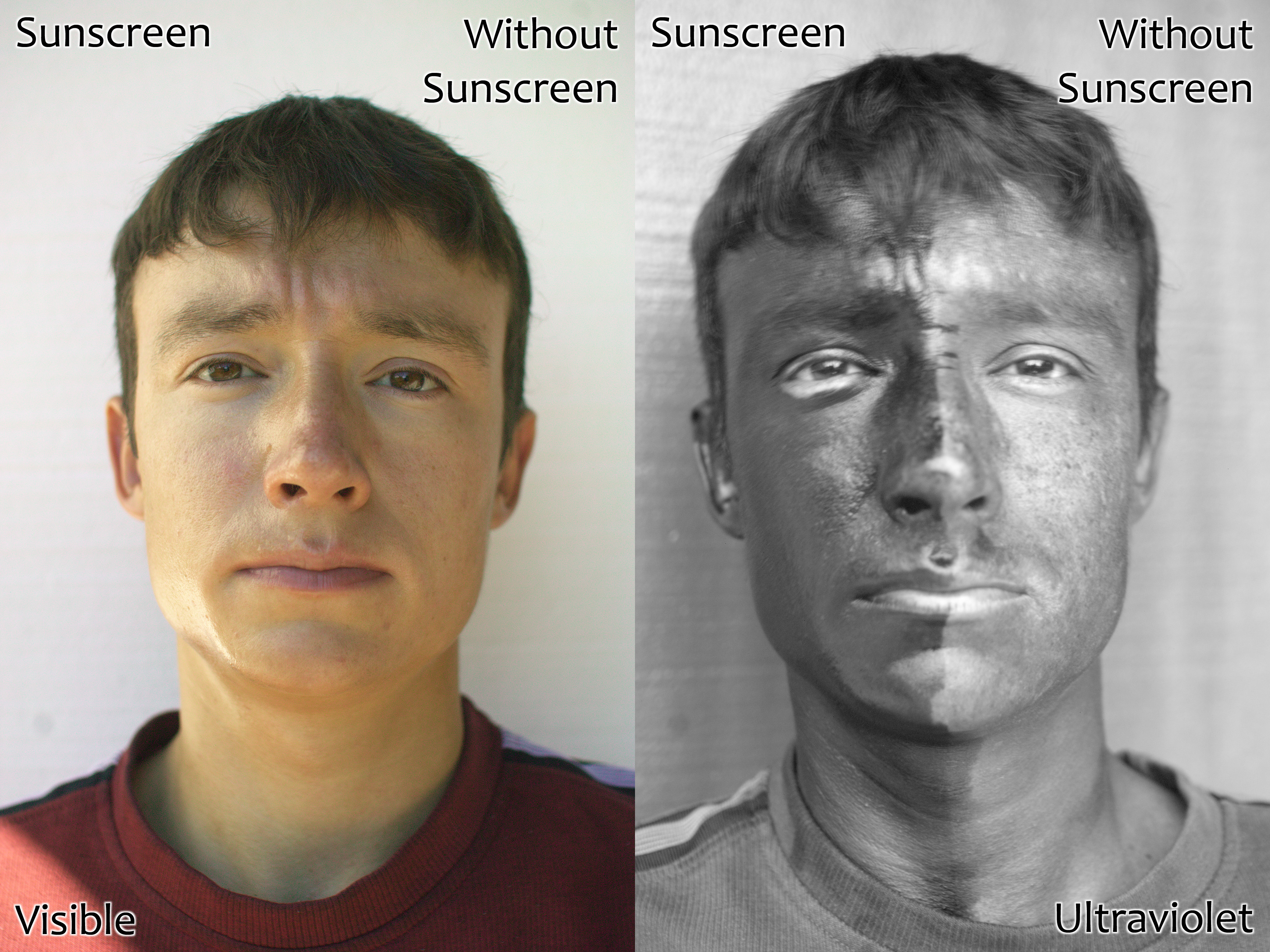 Visualizing primary prevention: A side-by-side comparison under visible and ultraviolet light demonstrates how sunscreen creates a physical barrier against UV radiation.