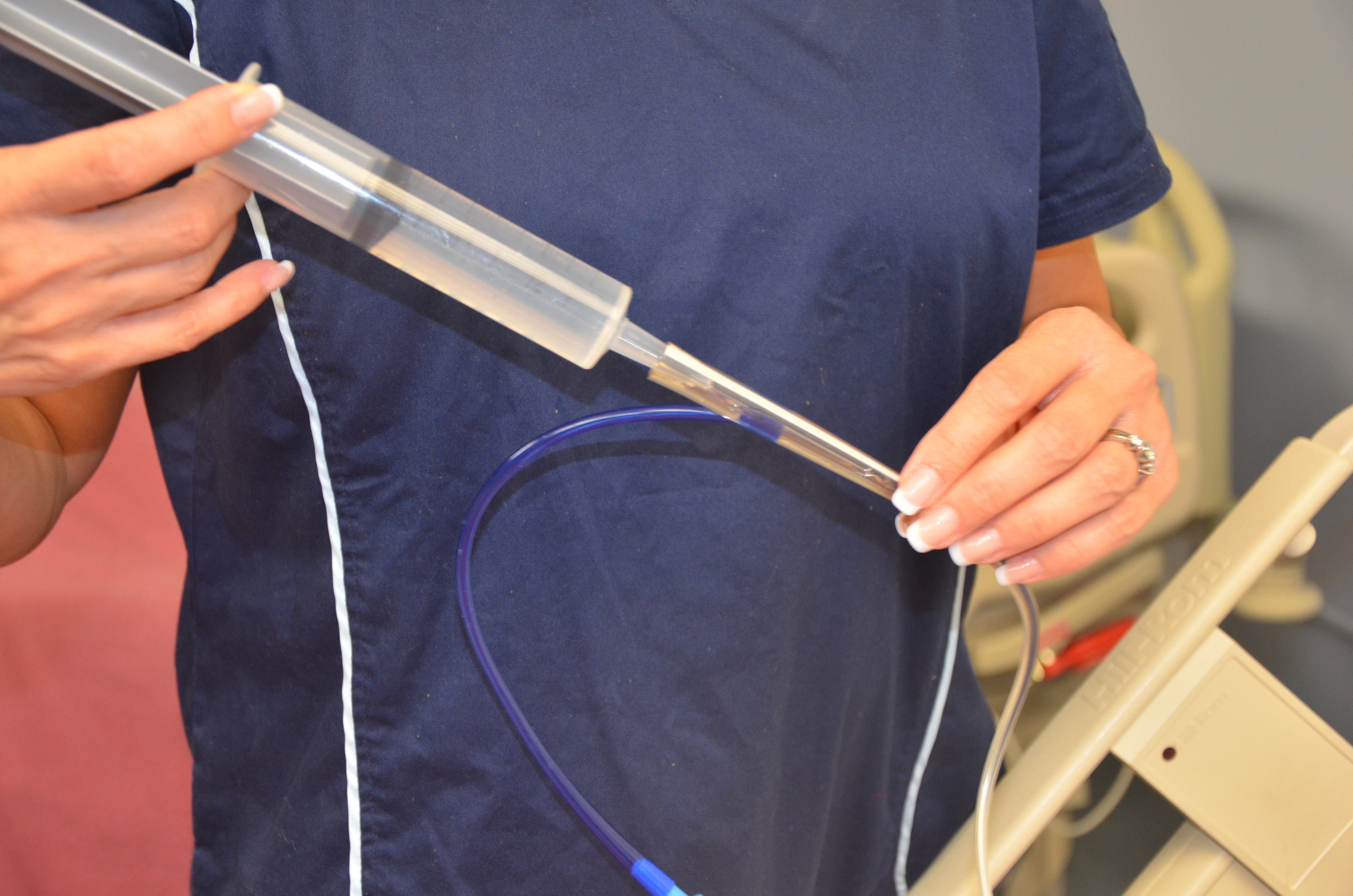 Medication administration via a gastric feeding tube requires all drugs to be thoroughly crushed and dissolved to maintain tube patency.