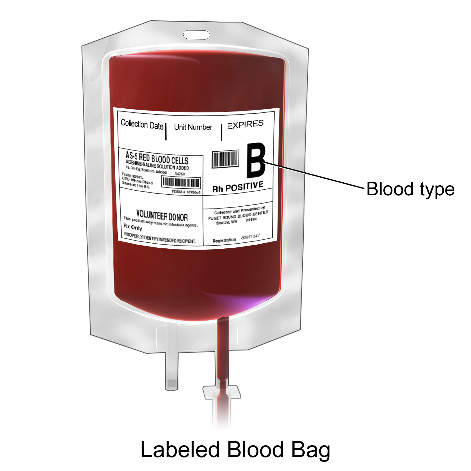 Bedside verification involves meticulously checking the blood bag's label against the patient's ID band, confirming blood type, unit number, and expiration date.