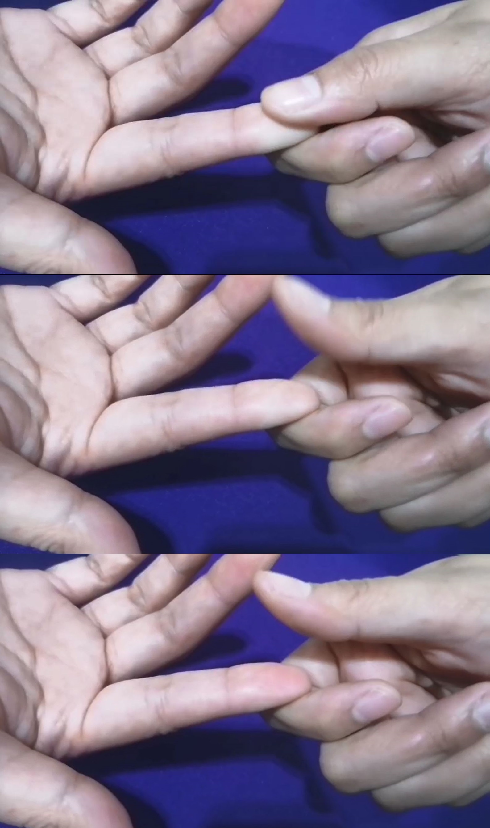 Evaluating capillary refill time offers a quick clinical window into peripheral tissue perfusion.