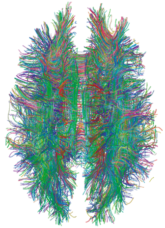 MRI tractography revealing white matter connections in the human brain. Reading comprehension relies on physically binding new textual information to these existing neural pathways.
