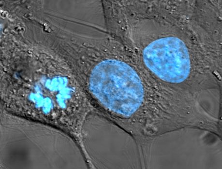 A microscopic photograph of a cellular structure. Without the caption explicitly stating that the blue-stained structures are DNA and the leftmost cell is undergoing mitosis, the visual data lacks meaning for the reader.