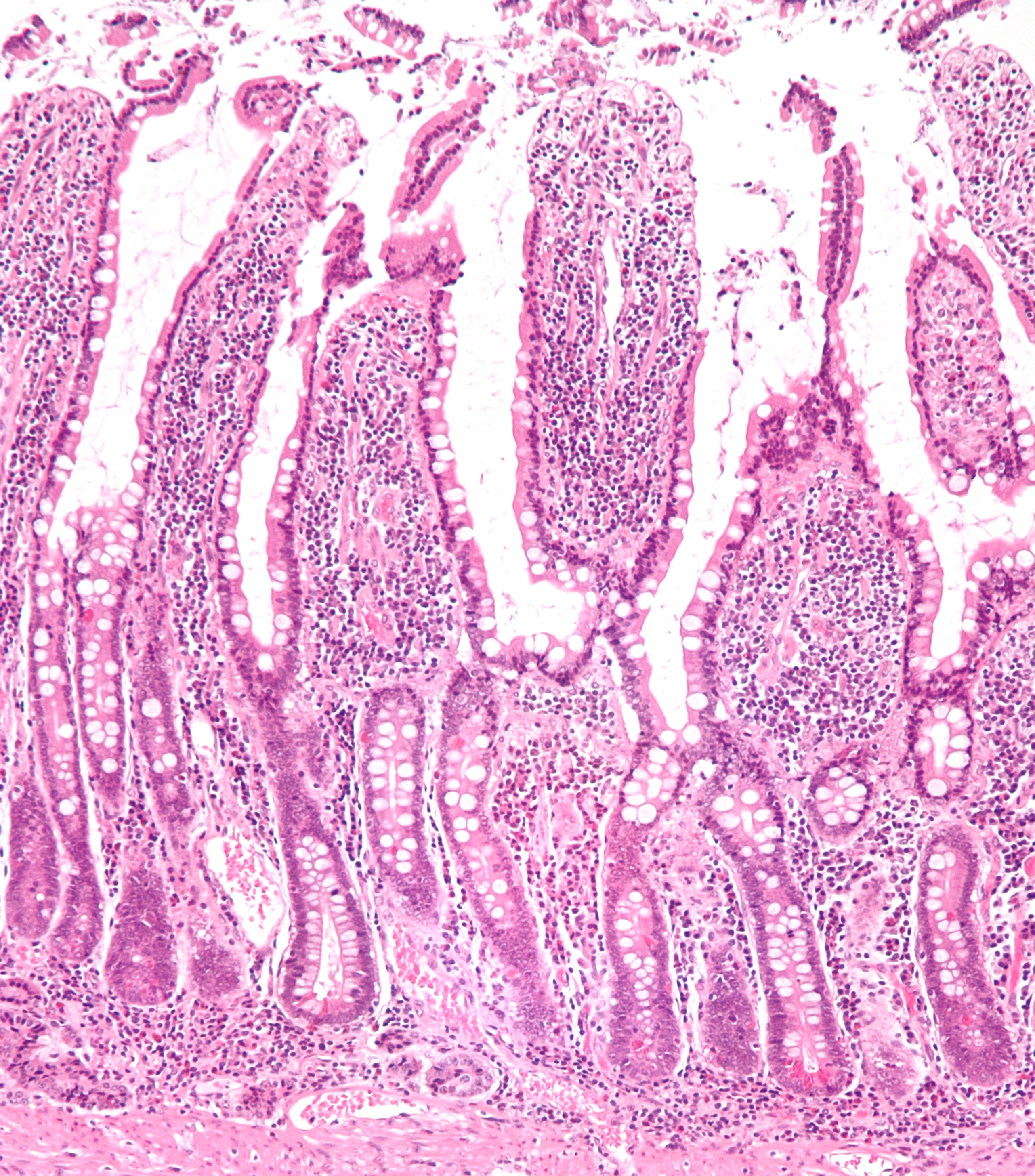 A microscopic view of the small intestinal mucosa showing the villi, which drastically increase the surface area available for cellular nutrient absorption.