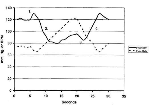 Hemodynamic changes during the Valsalva maneuver. While bearing down increases intra-abdominal pressure to assist in elimination, the resulting spike in intrathoracic pressure and pulse rate can be dangerous for cardiac patients.