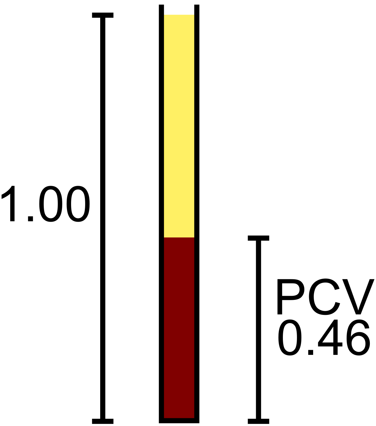 Hematocrit is conceptually and physically demonstrated by centrifuging a blood sample to separate the packed red blood cells from the plasma, providing a visual gauge of blood thickness.