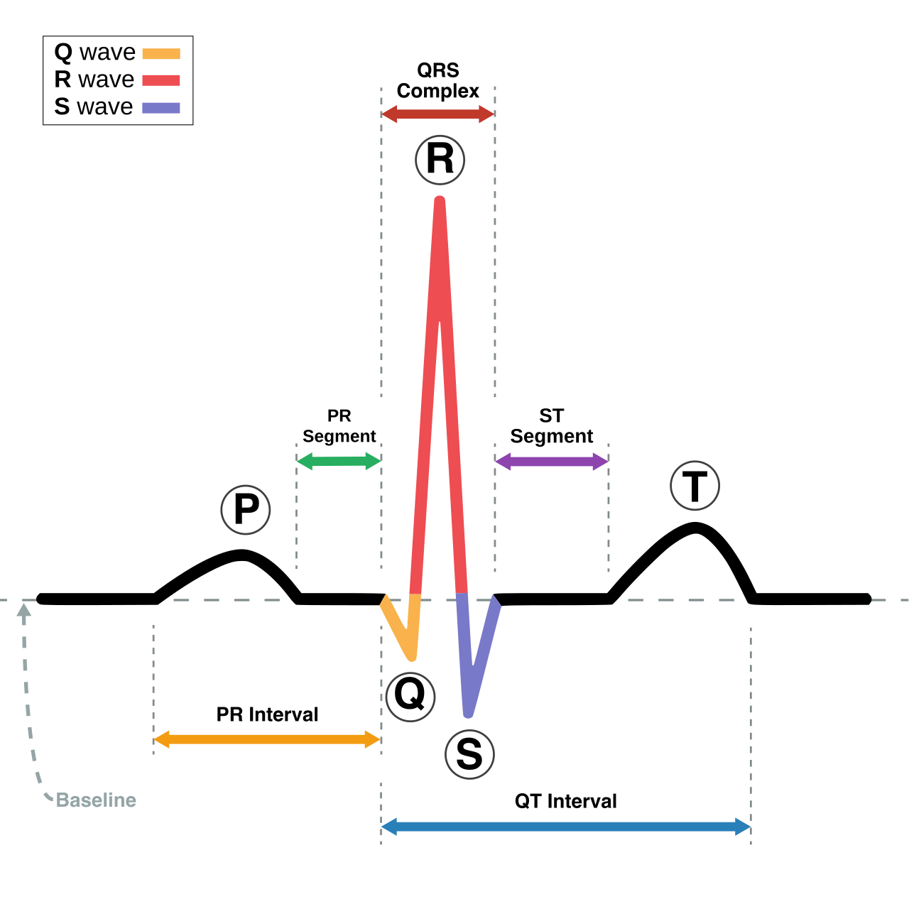 Schematic representation of a normal sinus rhythm electrocardiogram, identifying the key intervals: PR interval, QRS complex, and QT interval.