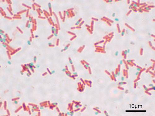 Bacterial endospores (stained green) are highly resilient, dormant structures that act like armor, allowing the bacteria to easily survive exposure to alcohol-based sanitizers.