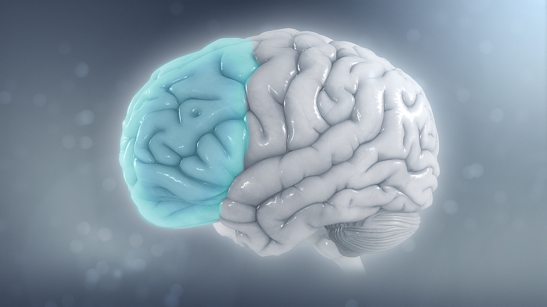 ADHD is a neurodevelopmental condition often associated with structural differences in the brain, such as reduced volume in the left prefrontal cortex.