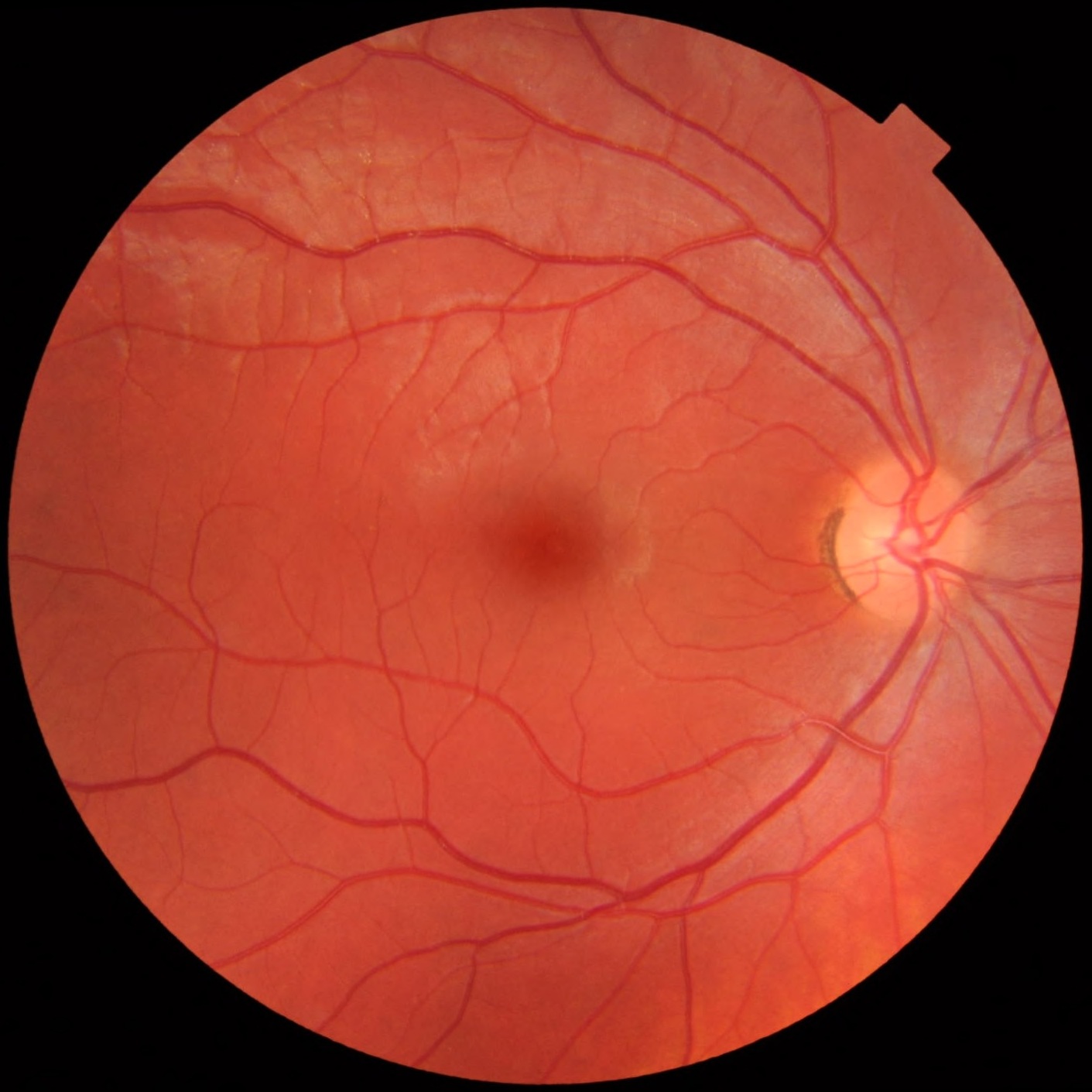 A photograph of a human retina, revealing the unique pattern of blood vessels measured by retinal scanners for high-security biometric authentication.