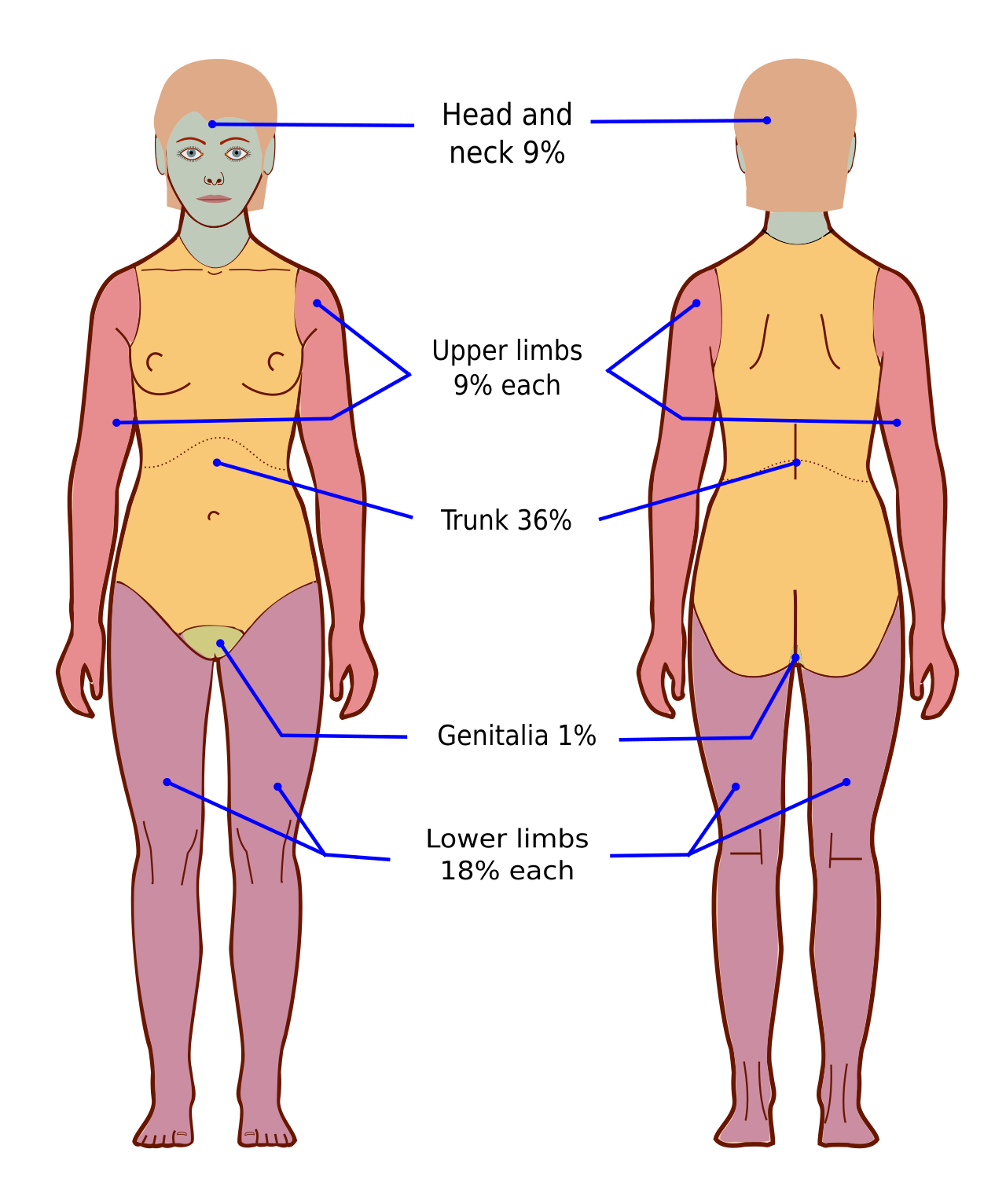 The 'Rule of Nines' is used to estimate the Total Body Surface Area (TBSA) affected by burns, demonstrating the clinical importance of understanding two-dimensional geometric measurements.