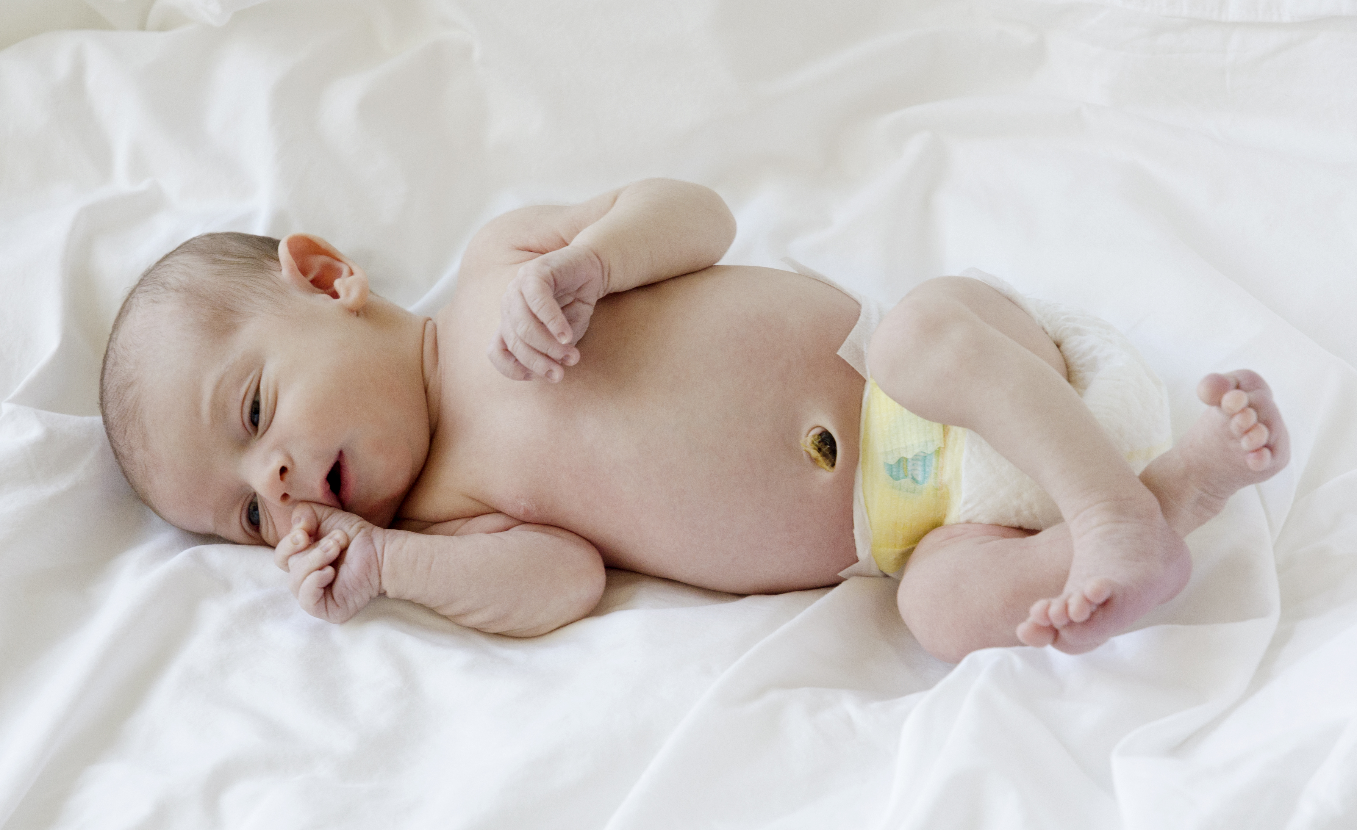 A day-old newborn with the umbilical cord stump still attached, which must be kept dry and exposed to room air until it falls off naturally.