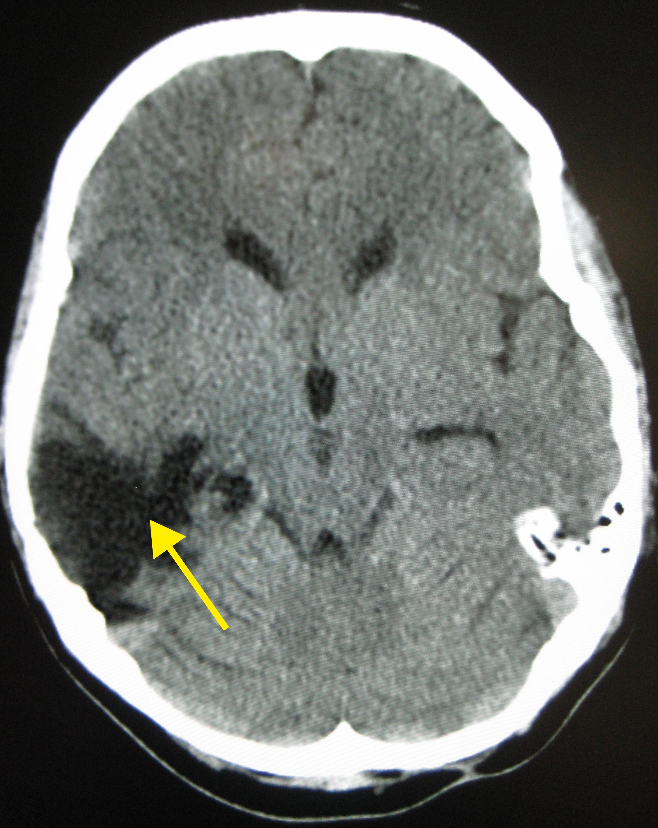 Complex cases, such as a student returning to school after a traumatic brain injury, require an interdependent team of medical and educational specialists to synthesize a cohesive plan.