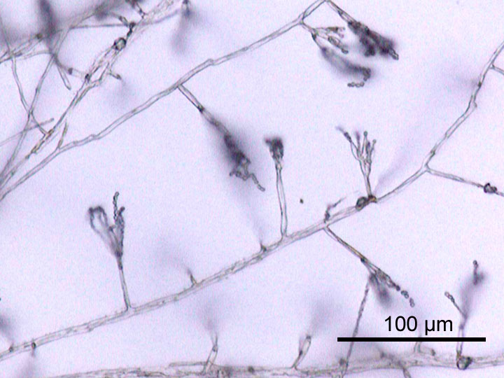 Microscopic view of branching fungal filaments known as hyphae, which allow multicellular molds to grow and absorb surrounding nutrients.