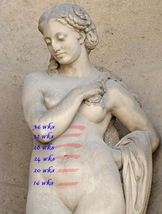 Illustration demonstrating the measurement of fundal height, which correlates in centimeters with the fetal age in weeks between 18 and 32 weeks of gestation.
