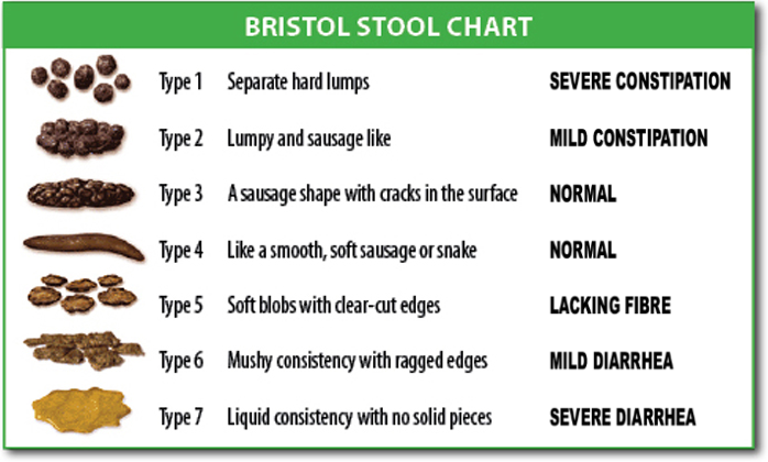 The Bristol Stool Scale is a standard clinical tool used to visually assess stool transit time and hydration, ranging from severe constipation (Type 1) to severe diarrhea (Type 7).