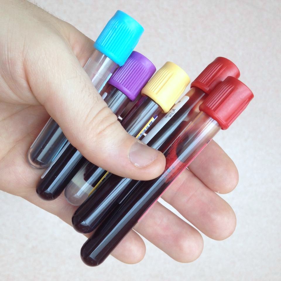 "After completing the blood draw, the phlebotomist labeled the vials." An introductory dependent phrase must be separated from the main independent clause by a comma.