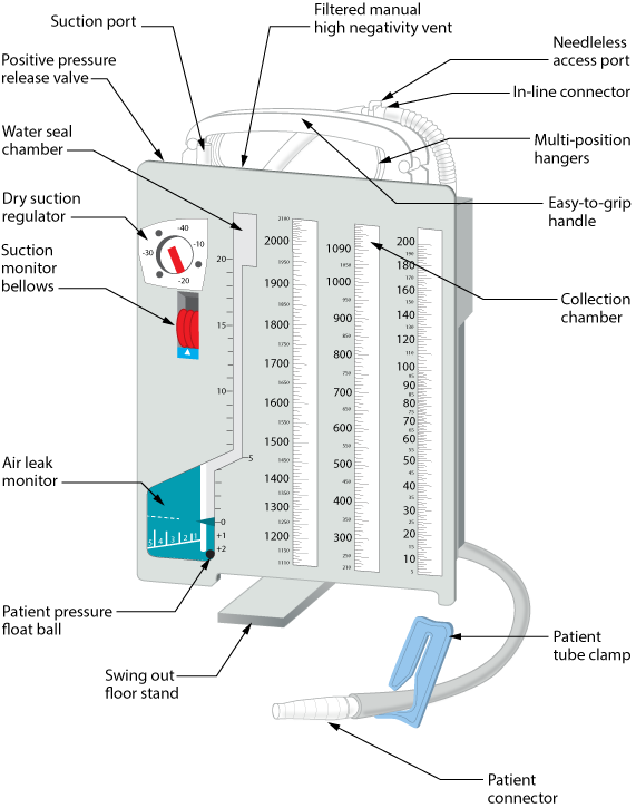 Schematic of a chest tube drainage system highlighting the water-seal chamber, which acts as a one-way valve to restore negative pressure in the pleural space.