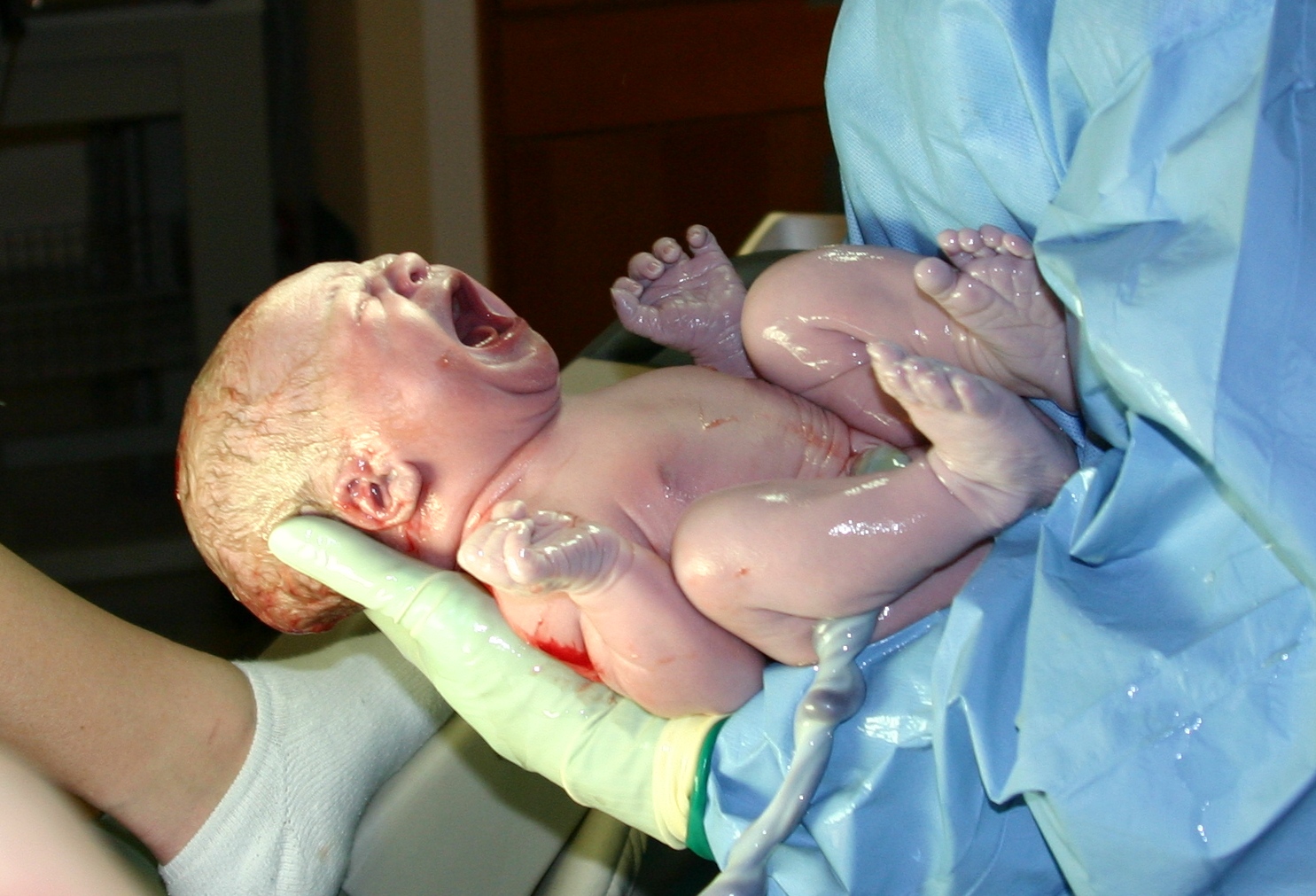 A newborn infant seconds after delivery, still attached to the umbilical cord before independent physiological transition.