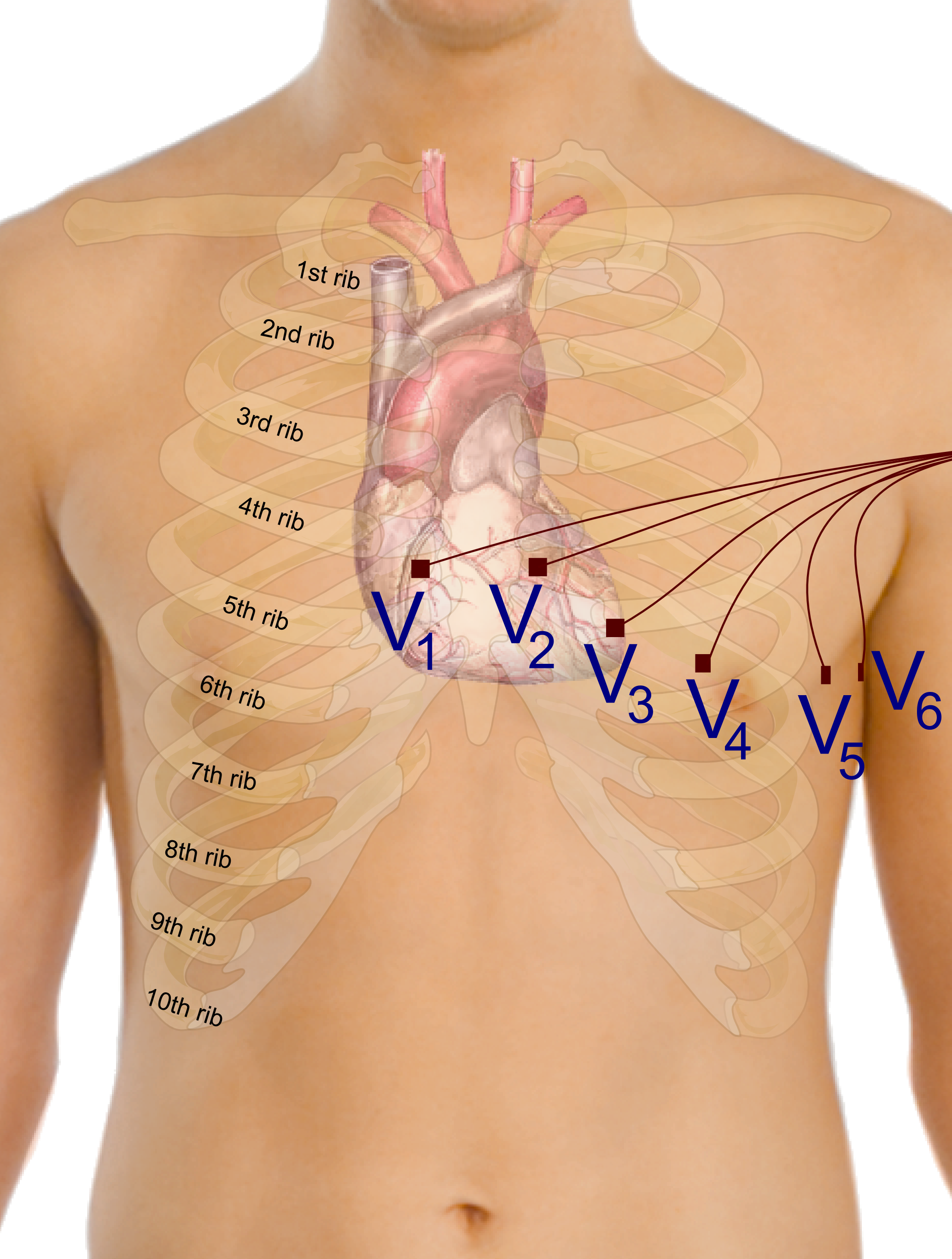 Map of precordial lead placement on the chest wall, illustrating the precise anatomical landmarks needed to accurately capture the electrical vectors of the ventricles.
