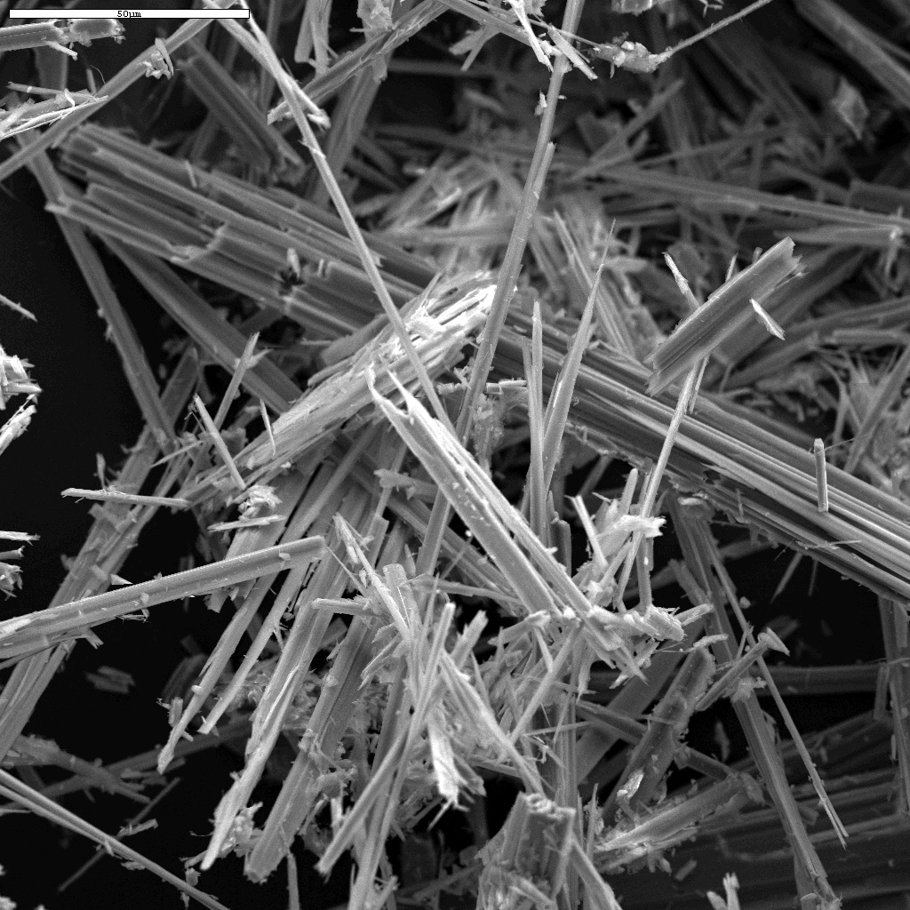 Microscopic asbestos fibres — a single fibre is believed capable of triggering mesothelioma, the scientific black hole in causation that Fairchild v Glenhaven Funeral Services was designed to solve.