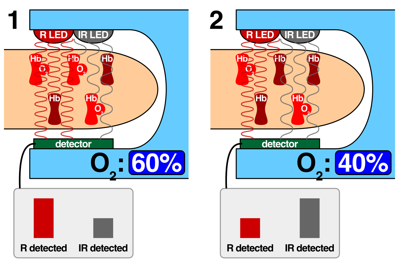 While a passage might detail the specific operating principles of devices like a transmissive pulse oximeter, the broader topic acts as the umbrella categorizing all such non-invasive tools.