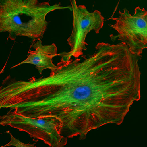 Fluorescence microscopy reveals the cytoskeleton—the dynamic network of protein filaments that maintains cell shape and acts as structural scaffolding.
