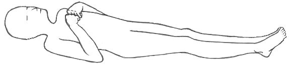 Decorticate posturing involves abnormal flexion of the upper extremities towards the body's core.