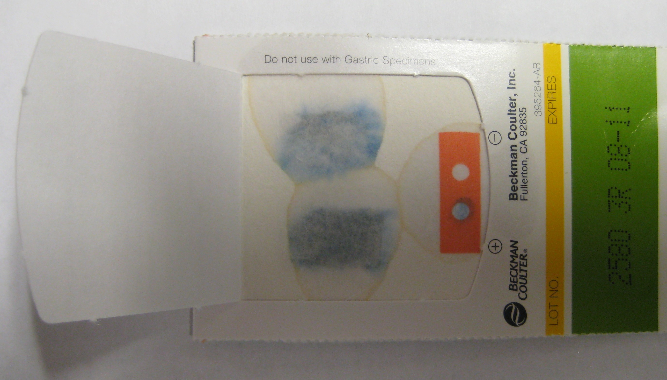 A positive fecal occult blood test card. The chemical reagents used on these cards can be altered by urine contamination, rendering the test invalid.