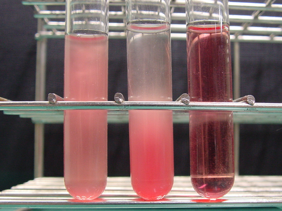 A comparison of normal blood plasma (left) and hemolyzed plasma (right). Hemolysis ruptures red blood cells, spilling intracellular contents like potassium into the sample, leading to falsely elevated laboratory results.