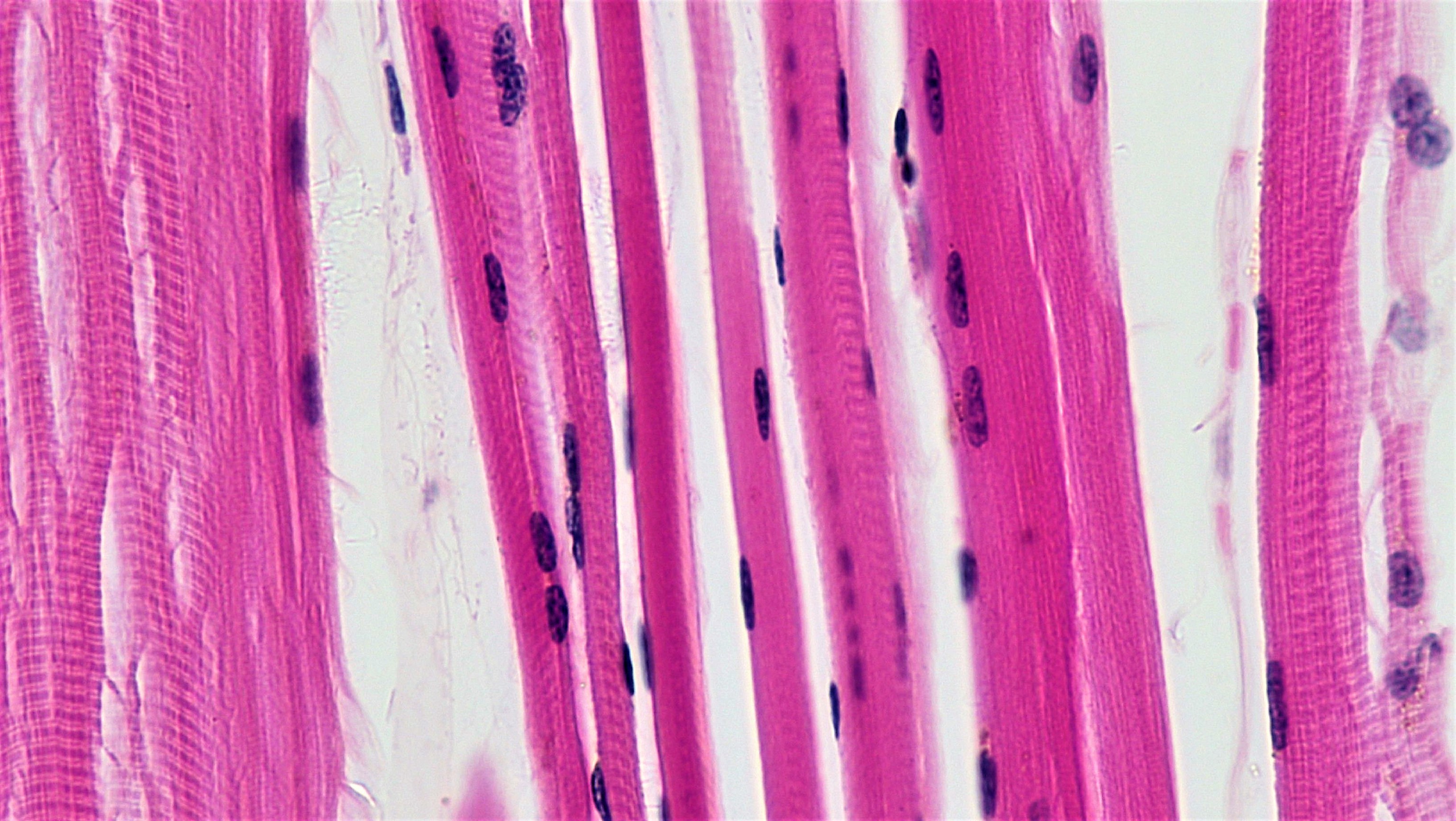 Microscopic view of skeletal muscle tissue, clearly displaying the organized, striated (striped) pattern and multiple nuclei typical of these voluntary, high-volume muscle cells.