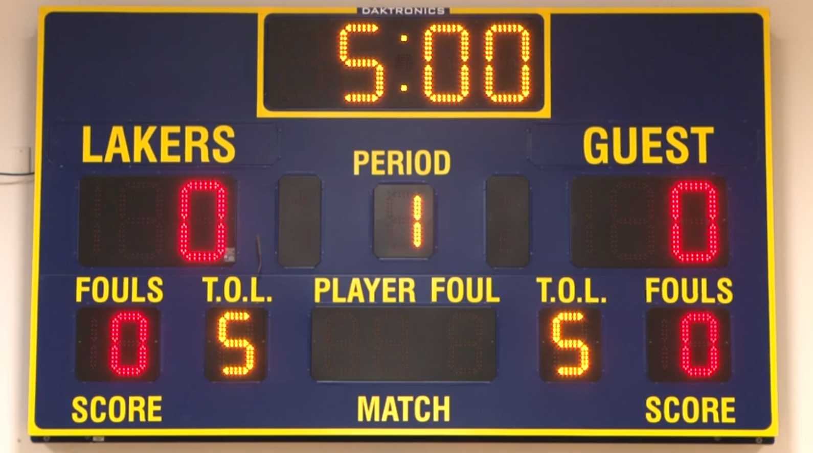 Like a sports scoreboard, an information radiator serves as a highly visible display that makes critical project status immediately apparent to everyone without the need for formal reports.