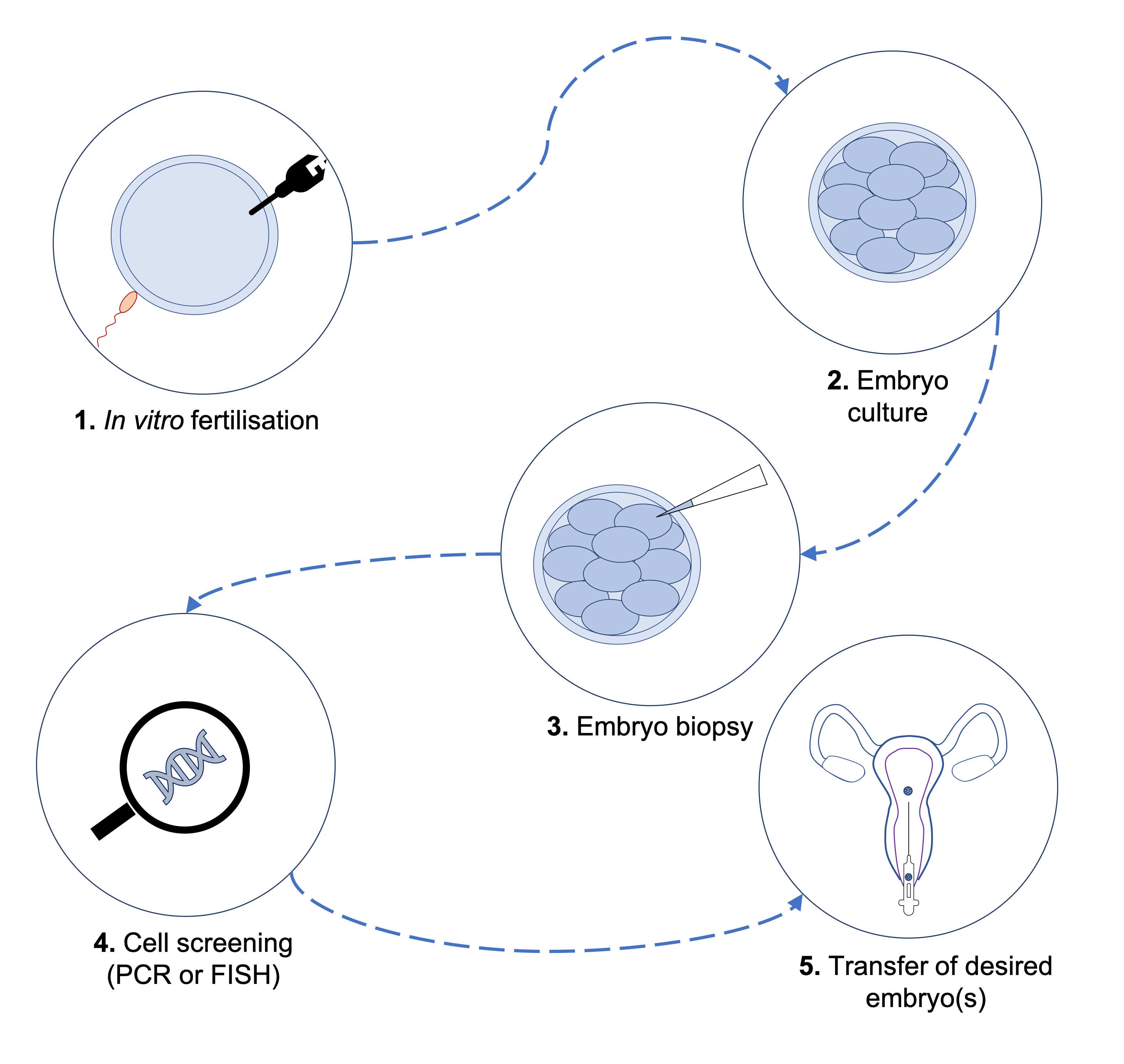 Preimplantation genetic diagnosis (PGD) allows embryos created via in vitro fertilization to be screened for specific genetic conditions prior to implantation.