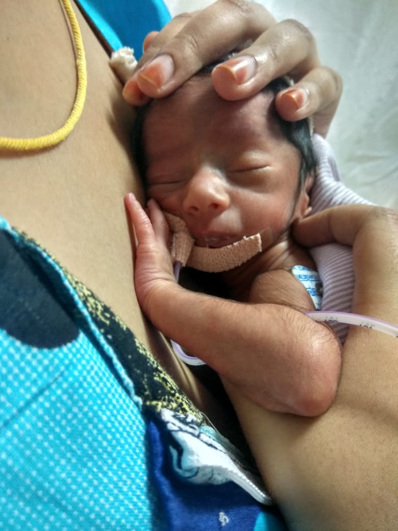 Kangaroo care involves placing the neonate skin-to-skin on the parent's bare chest, which acts as a bio-incubator to promote thermoregulation.