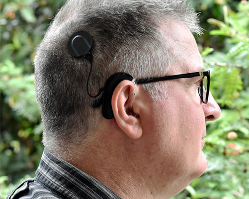 Because they rely on surgically implanted medical components, devices like cochlear implants are explicitly excluded from a school district's assistive technology obligations under IDEA.
