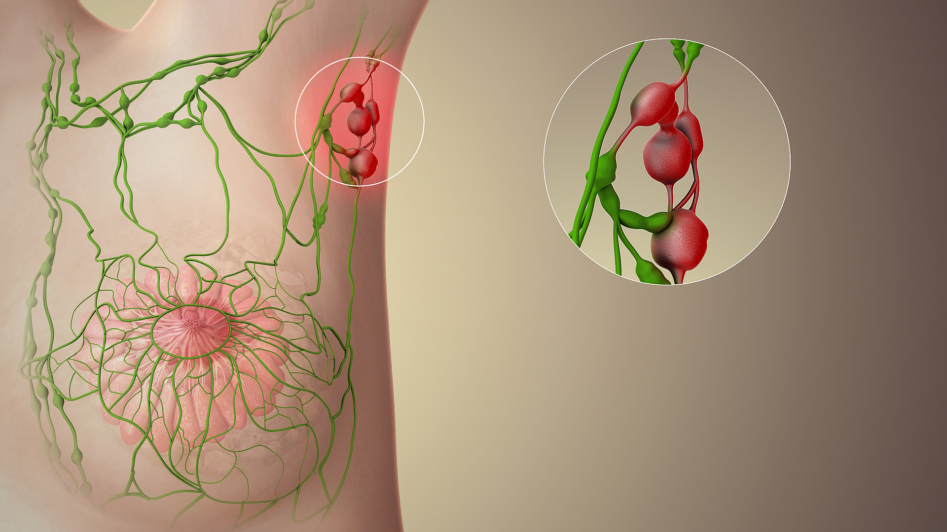 Enlarged lymph nodes provide critical diagnostic clues during palpation; tender, mobile nodes suggest an acute infection, whereas hard, fixed nodes may indicate underlying malignancy.