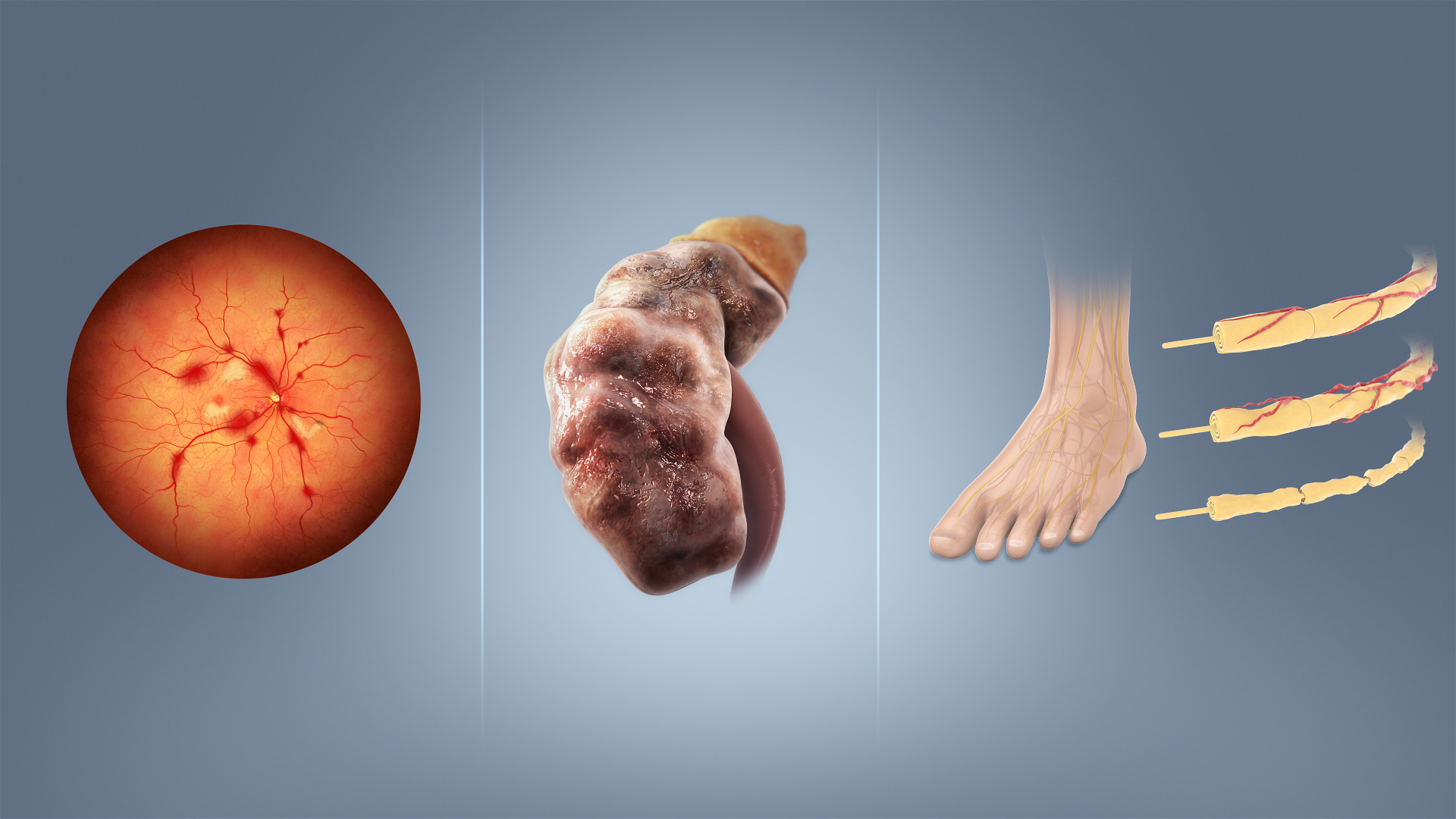 Unchecked hyperglycemia damages small vessels and nerves over time. Routine screening of fasting glucose and Hemoglobin A1c catches this silent damage before major complications like retinopathy or nephropathy occur.