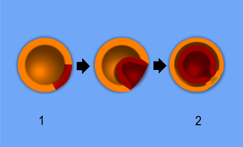 Gastrulation in a developing embryo, demonstrating the active inward cellular migration that forms the archenteron and establishes the distinct embryonic germ layers.