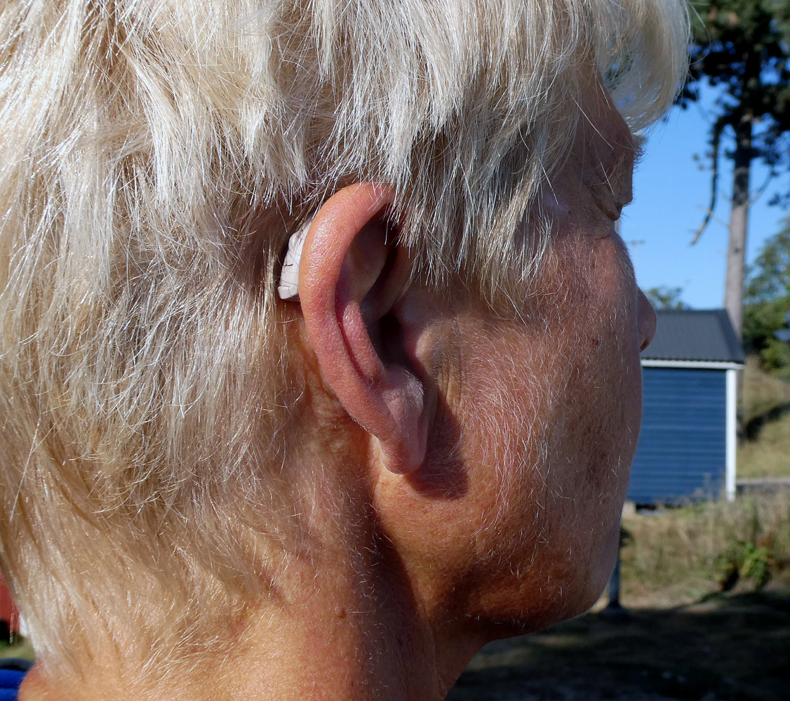 A modern behind-the-ear hearing aid. If the earpiece is not fitted snugly within the ear canal, amplified sound can leak out and be recaptured by the device's microphone, resulting in a high-pitched feedback whistle.