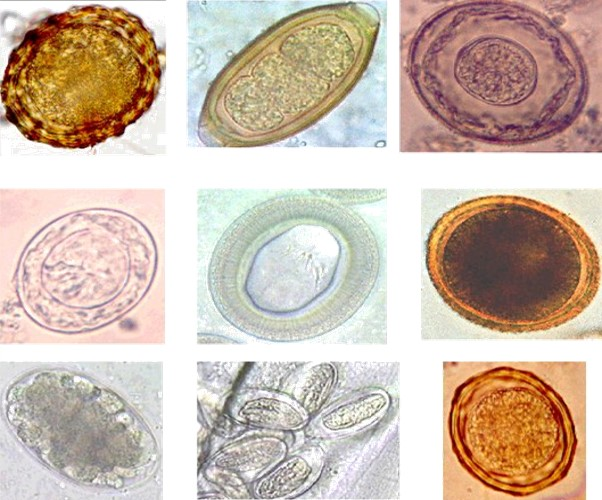 While adult parasitic worms are macroscopic, they are frequently diagnosed in clinical microbiology through the microscopic identification of their eggs.