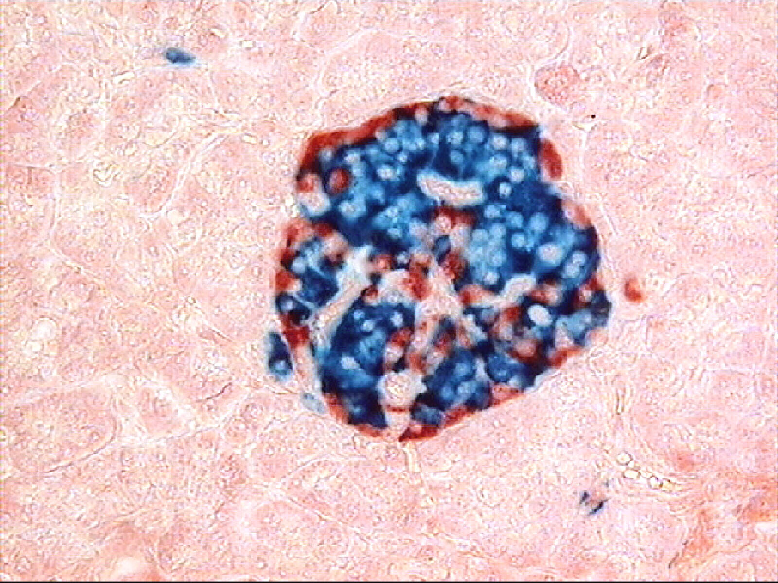 Immunofluorescent micrograph of a pancreatic islet. Beta cells (stained green) secrete insulin centrally to lower blood glucose, while peripheral alpha cells secrete glucagon to raise it.