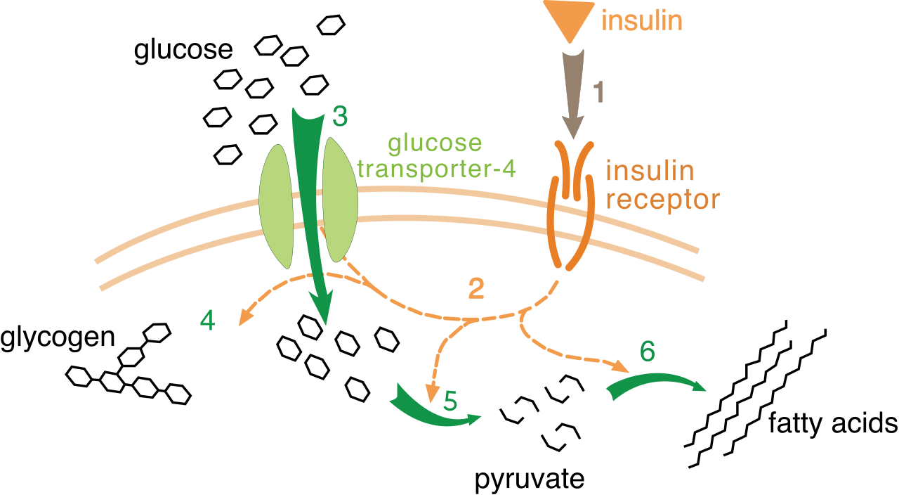 The normal mechanism of insulin facilitating cellular glucose uptake. Disruption of this pathway leads to the clinical manifestations of both Type 1 and Type 2 diabetes.