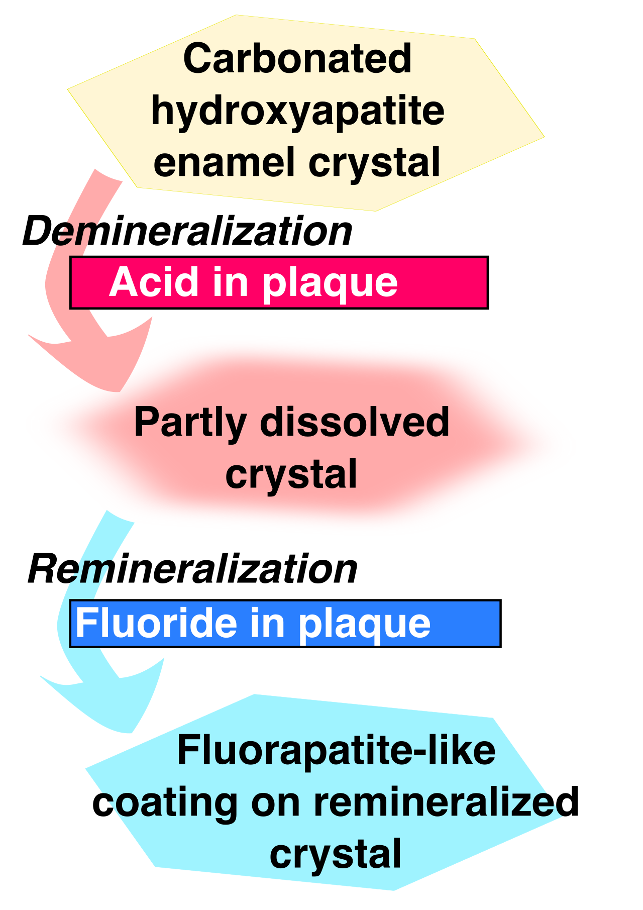 The mechanism of population-level primary prevention: Fluoride in community water supplies promotes the remineralization of dental enamel, halting decay before a cavity forms.