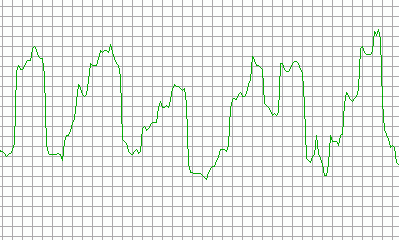 Eye-tracking measurements visualize the left-to-right micro-navigation of English print, as well as the rapid right-to-left saccades known as the return sweep required to start a new line.